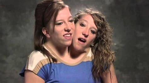 conjoined twins porn|Twins together getting all ready with no frills